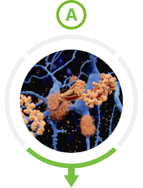 Amyloid Plaques