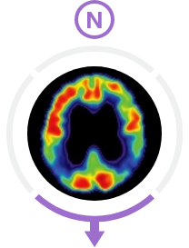 Neurodegeneration